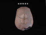 L_V19d5002 A15.52 Q824 dM pa skull top view 